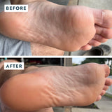 VOESH New York | Solemate Heel Repair Balm - Mint