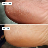 VOESH New York | Solemate Heel Repair Balm - Mint